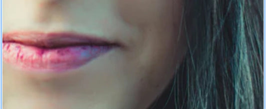 Biting Your Lips and Peeling the Skin Off? 5 Steps to Overcome Compulsive Lip Biting