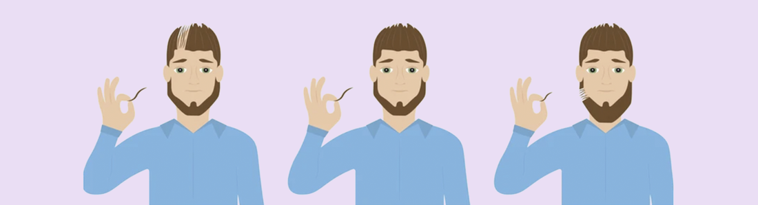 Breaking the Silence: Trichotillomania and Men